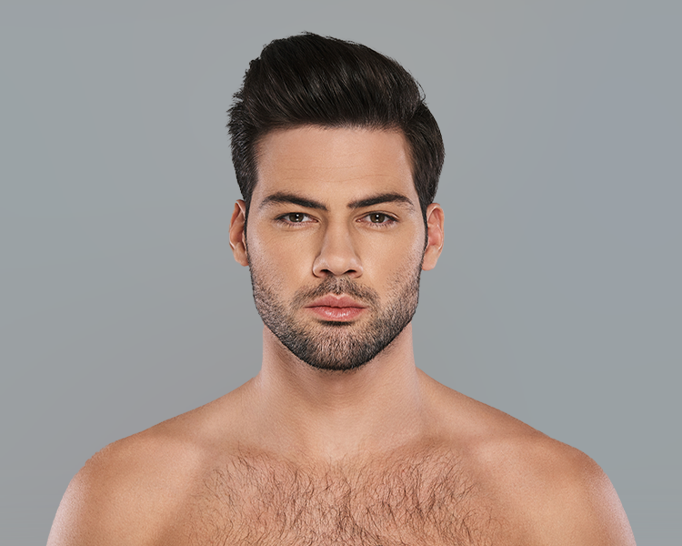 Mobile Dermal Fillers