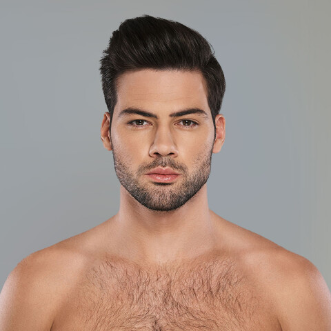 Dermal Fillers 05