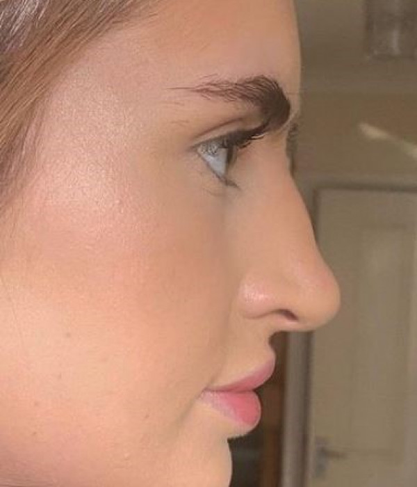 Bethany Frankland rhino before