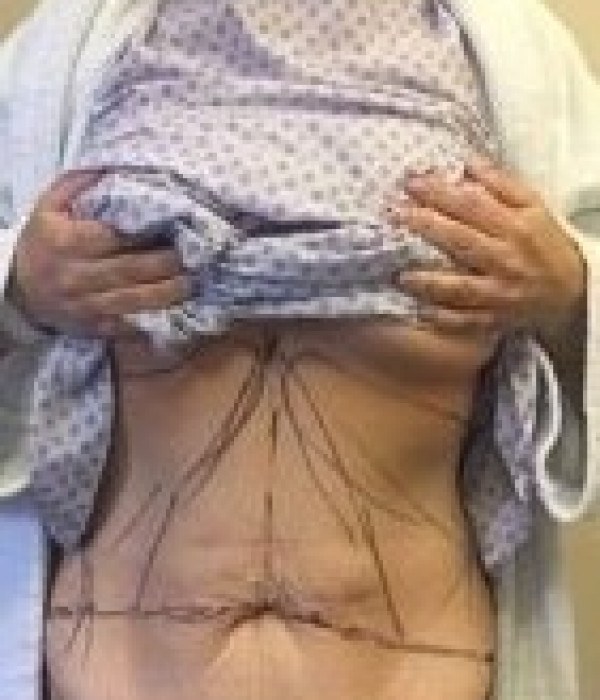 TT 1 Before