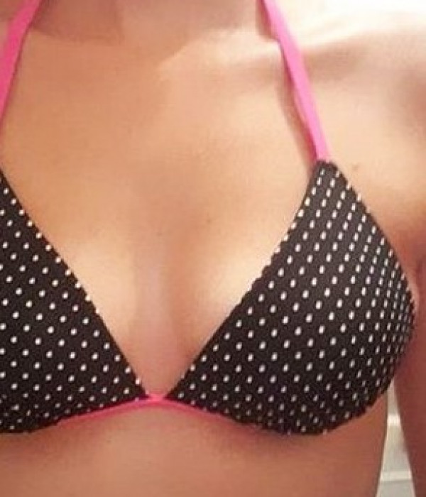 breast enlargement ba 18 Before