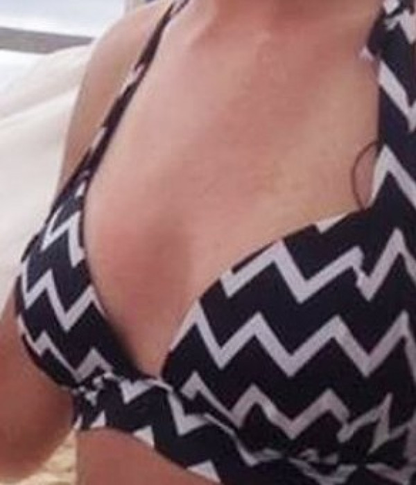 breast enlargement ba 19 Before