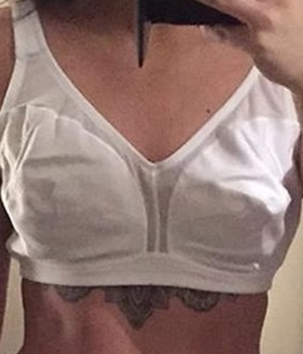 breast enlargement ba 1 Before