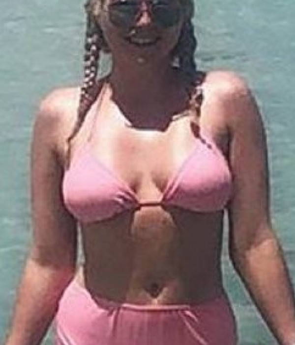 breast enlargement ba 24 Before
