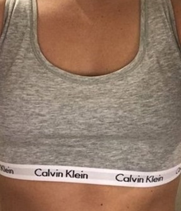breast enlargement ba 9 Before